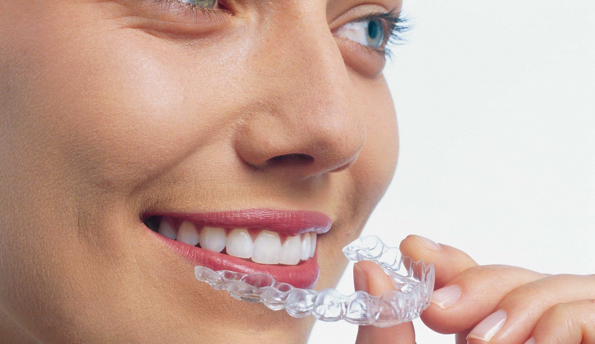 Une orthodontie efficace, discrète pour une satisfaction esthétique.